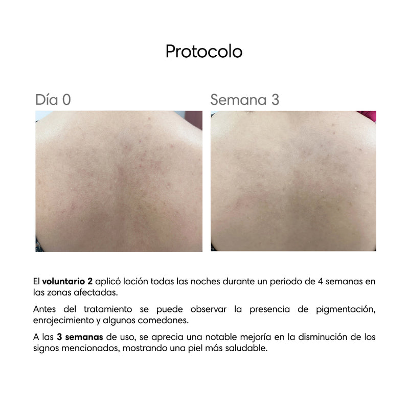 Oxidermic Prebiotic Body Lotion